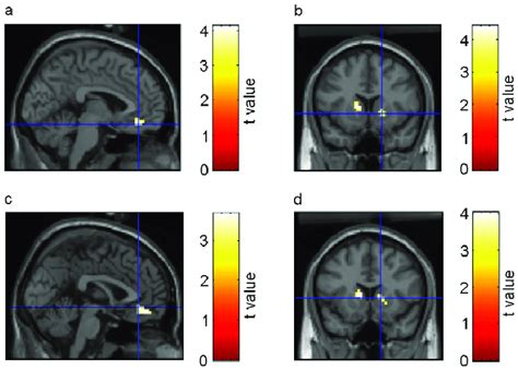 activation of the ventral striatum.